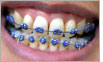 Orthodontics with 'Feeling'